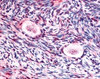 Immunohistochemistry staining of GSK3B in ovary tissue using GSK3B Antibody.