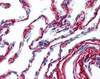 Immunohistochemistry staining of COL6A1 in lung (formalin-fixed paraffin embedded) using COL6A1 Antibody.