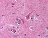 Immunohistochemistry staining of Slit Homolog 1 in brain cortex tissue using Slit Homolog 1 Antibody.