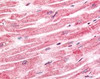 Immunohistochemistry staining of SPRY4 in heart tissue using SPRY4 Antibody.