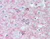 Immunohistochemistry staining of Adenosine A2a Receptor in brain, putamen tissue using Adenosine A2a Receptor monoclonal Antibody.