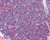 Immunohistochemistry staining of IL-7 Receptor in colon tissue using IL-7 Receptor Antibody.