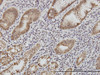 Immunoperoxidase of monoclonal antibody to CDH1 on formalin-fixed paraffin-embedded human stomach (antibody concentration 3 &#956;g/mL) .