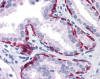 Immunohistochemistry of human prostate tissue stained using KRT81 Monoclonal Antibody.