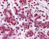 Immunohistochemistry of human breast tissue stained using VDR Monoclonal Antibody.