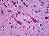 Immunohistochemistry of human brain cortex tissue stained using PCSK1 Monoclonal Antibody.