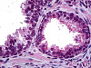 Immunohistochemistry of human prostate tissue stained using HIPK2 Monoclonal Antibody.