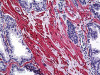 Immunohistochemistry of human prostate tissue stained using SMURF1 Monoclonal Antibody.
