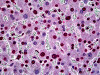 Immunohistochemistry of human liver tissue stained using SGK1 Monoclonal Antibody.