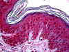 Immunohistochemistry of human skin tissue stained using TSG101 Monoclonal Antibody.