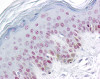 Immunohistochemistry of human skin tissue stained using RBM3 Monoclonal Antibody.