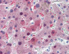Immunohistochemistry of human liver tissue stained using GSTA1 Monoclonal Antibody.