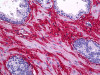 Immunohistochemistry of human prostate tissue stained using COL1A1 Monoclonal Antibody.