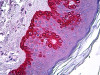 Immunohistochemistry of human skin tissue stained using CELA1 Monoclonal Antibody.