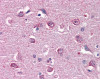 Immunohistochemistry of human brain cortex tissue stained using CAMK2B Monoclonal Antibody.