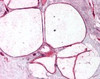 Immunohistochemistry staining of CAV3 in breast, adipocytes tissue using CAV3 Antibody.