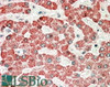 42-050 (1ug/ml) staining of Human Pancreas (A) , Heart (B) and Skeletal Muscle (C) lysates (35ug protein in RIPA buffer) . Primary incubation was 1 hour. Detected by chemiluminescence.