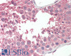 42-059 (3.8ug/ml) staining of paraffin embedded Human Liver. Steamed antigen retrieval with citrate buffer pH 6, AP-staining.
