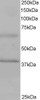 45-188 staining (1ug/ml) of Human Heart lysate (RIPA buffer, 35ug total protein per lane) . Primary incubated for 1 hour. Detected by western blot using chemiluminescence.