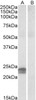 42-116 (0.03ug/ml) staining of HepG2 lysates (35ug protein in RIPA buffer) . Detected by chemiluminescence.