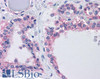 42-155 (1ug/ml) staining of Human Spleen lysate (35ug protein in RIPA buffer) . Primary incubation was 1 hour. Detected by chemiluminescence.