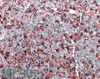 42-180 (3.8ug/ml) staining of paraffin embedded Human Skin. Steamed antigen retrieval with citrate buffer pH 6, AP-staining.