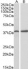 42-188 (1ug/ml) staining of Mouse Pancreas lysate (35ug protein in RIPA buffer) . Primary incubation was 1 hour. Detected by chemiluminescence.