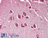 42-280 (0.1ug/ml) staining of Human Brain (Amygdala) lysate (35ug protein in RIPA buffer) . Primary incubation was 1 hour. Detected by chemiluminescence.