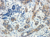 Lane A - 42-302 (1ug/ml) staining of HEK293 overexpressing Human DYDC1 lysate (10ug protein in RIPA buffer) Lane B - 42-302 (1ug/ml) staining of HEK293 mock-transfected lysate (10ug protein in RIPA buffer) . Lane C - anti-MYC Tag (1/1000) stainin