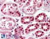 42-388 Flow cytometric analysis of paraformaldehyde fixed NIH3T3 cells (blue line) , permeabilized with 0.5% Triton, showing a low level of staining. Primary incubation 1hr (10ug/ml) followed by Alexa Fluor 488 secondary antibody (1ug/ml) . IgG control: Un