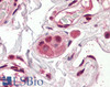 42-389 (3.75ug/ml) staining of paraffin embedded Human Colon. Steamed antigen retrieval with citrate buffer pH 6, AP-staining.