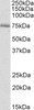 HEK293 lysate (10ug protein in RIPA buffer) overexpressing Human KCTD11 with DYKDDDDK tag probed with 42-417 (1.0ug/ml) in Lane A and probed with anti-DYKDDDDK Tag (1/5000) in lane C. Mock-transfected HEK293 probed with 42-417 (1mg/ml) in Lane B. Primar