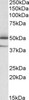 HEK293 lysate (10ug protein in RIPA buffer) overexpressing Human EPM2AI with DYKDDDDK tag probed with 42-433 (1ug/ml) in Lane A and probed with anti-DYKDDDDK Tag (1/1000) in lane C. Mock-transfected HEK293 probed with 42-433 (1mg/ml) in Lane B. Primar