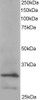 45-011 (3.8µg/ml) staining of paraffin embedded Human Spleen. Steamed antigen retrieval with citrate buffer pH 6, AP-staining.