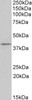 42-442 (0.2ug/ml) staining of Human Cerebellum lysate (35ug protein in RIPA buffer) . Primary incubation was 1 hour. Detected by chemiluminescence.