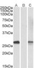 42-516 (5ug/ml) staining of paraffin embedded Human Heart. Steamed antigen retrieval with citrate buffer pH 6, AP-staining.