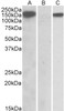 42-610 (1.5ug/ml) as the reporter antibody.