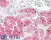 42-630 (1ug/ml) staining of Mouse Lung lysate (35ug protein in RIPA buffer) . Primary incubation was 1 hour. Detected by chemiluminescence.