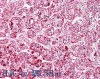 42-661 (1ug/ml) staining of Human Thymus lysate (35ug protein in RIPA buffer) . Primary incubation was 1 hour. Detected by chemiluminescence.