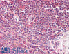 42-681 (3.8ug/ml) staining of paraffin embedded Human Skeletal Muscle. Steamed antigen retrieval with citrate buffer pH 6, AP-staining.