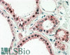 42-738 (0.3ug/ml) staining of A431 lysate (35ug protein in RIPA buffer) . Primary incubation was 1 hour. Detected by chemiluminescence.