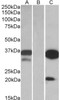 42-759 (1.5ug/ml) staining of paraffin embedded Human Testis (Mast cells) . Steamed antigen retrieval with citrate buffer pH 6, AP-staining.