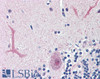 45-603 (3.75ug/ml) staining of paraffin embedded Human Cerebellum. Steamed antigen retrieval with citrate buffer pH 6, AP-staining. <strong>This data is from a previous batch, not on sale.</strong>