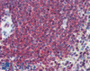 42-777 (1ug/ml) staining of untreated (first lane) and TGF-bl-treated (second lane) primary cultured Human Lung fibroblast lysate. Primary incubated overnight at 4C. Detected by western blot using chemiluminescence. Data kindly provided by Nickolai Dulin