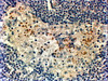 45-605 (2ug/ml) staining of paraffin embedded Human Breast