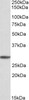 42-823 (0.1ug/ml) staining of Rat Lung lysate (35ug protein in RIPA buffer) . Primary incubation was 1 hour. Detected by chemiluminescence.