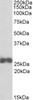 42-829 (0.3ug/ml) staining of NIH3T3 (A) , Mouse Spleen (B) , Rat Spleen (C) ) lysates (35ug protein in RIPA buffer) . Primary incubation was 1 hour. Detected by chemiluminescence.