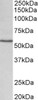 42-901 (0.5ug/ml) staining of Human Liver (A) and (1ug/ml) Lung (B) lysate (35ug protein in RIPA buffer) . Primary incubation was 1 hour. Detected by chemiluminescence.