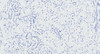 42-917 (0.3ug/ml) staining of Mouse (A) and Rat (B) Liver lysate (35ug protein in RIPA buffer) . Primary incubation was 1 hour. Detected by chemiluminescence.