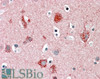 45-916 (0.1ug/ml) staining of Human Brain lysate (35ug protein in RIPA buffer) . Primary incubation was 1 hour. Detected by chemiluminescence.